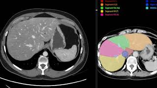 Anatomia de abdomen y pelvis por tomografia computada [upl. by Mendel]