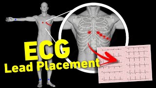 ECG lead placement MADE EASY  12 lead ECG placement  How to perform ECG • Daily Cardiology [upl. by Thierry]