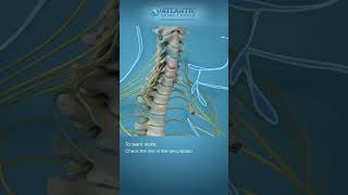 What is Endoscopic Anterior Cervical Discectomy Shorts [upl. by Nnylatsyrk]