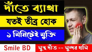 দাঁতের ব্যথা দূর করার উপায় দাঁতের ব্যথা কমানোর উপয় দাঁতের ব্যথায় করনীয় dat betha hole koronio [upl. by Areis135]