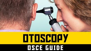 Otoscopy OSCE Guide [upl. by Aciret535]