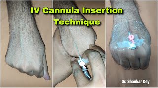 Intravenous Cannula Insertion Technique  Demonstration Video  Dr Shankar Dey [upl. by Yramanna382]