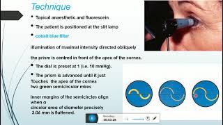 goldmann and other forms of tonometry [upl. by Gibbons731]