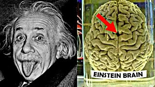 How Einsteins Brain was Different [upl. by Caprice]