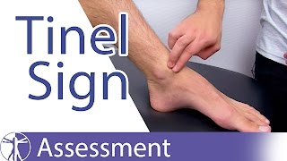 Tinels Sign Ankle⎟Peripheral Nerve Injury [upl. by Washburn]