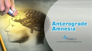 Anterograde amnesia [upl. by Yves797]