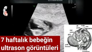 7 haftalık gebelikte bebek ultrason görüntüleri gebelik kesesi yolk kesesi ve kalp atışları [upl. by Skilken631]