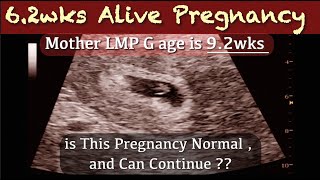 6 wks Early Pregnancy Ultrasound  Mother LMP G Age is 9wks  is this Normal [upl. by Ainoloppa75]