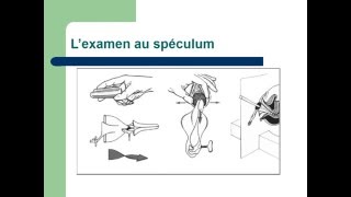 GYNECOLOGIE L’examen en gynécologie [upl. by Yeltnerb]