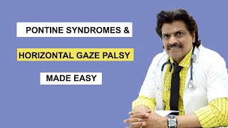 PONTINE SYNDROMES amp HORIZONTAL GAZE PALSY MADE EASY [upl. by Won708]