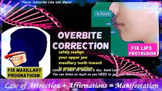 affirmations overbite correction get rid of lip protrusion maxillary prognathism correction [upl. by Yob313]