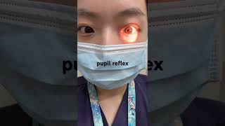 pupil reflex [upl. by Dimmick]