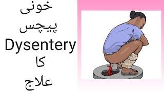 Bloody motion  Dysentery  Homeo treatment  By DrSohail Janjua [upl. by Ytsirt]