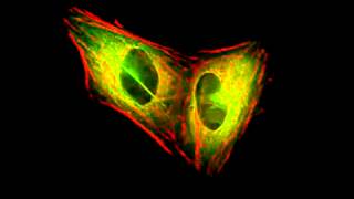 Actin and tubulin during mitosis [upl. by Aip]