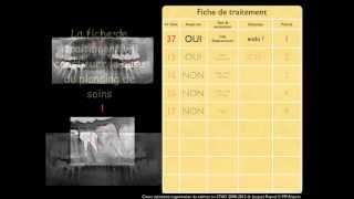 Gestion du plan de traitement en CFAO dentairemov [upl. by Doug]