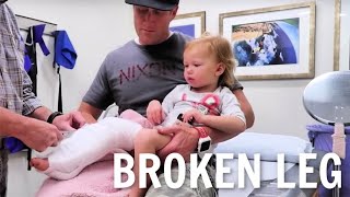 Getting a cast on her Broken leg [upl. by Neelrahs771]