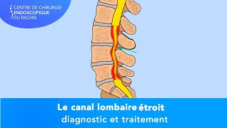 CANAL LOMBAIRE ÉTROIT  Questceque cest [upl. by Talmud62]