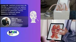 Lipotransferencia en Glúteos Rostro y Senos incluye factores de riesgo por el Doctor Edgar Terán [upl. by Namdor]