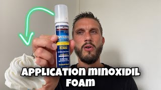 Comment appliquer le minoxidil Foamen mousse￼ [upl. by Ethelin]