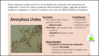 Amorphous urates crystal in urine [upl. by Nhepets]