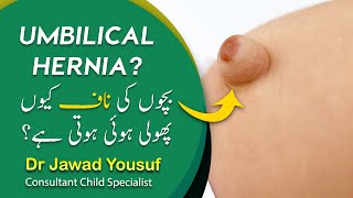 Umbilical hernia in babies What is umbilical hernia   Dr Jawad Yousuf [upl. by Taimi111]