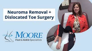 Neuroma Removal and Dislocated Toe Surgery Patient Testimonial  Moore Foot amp Ankle [upl. by Brittany]