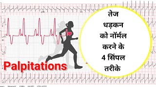 How to stop palpitations without medicine I Palpitation को बिना दवाई के तुरंत कैसे ठीक करे Hindi [upl. by Matthaus]