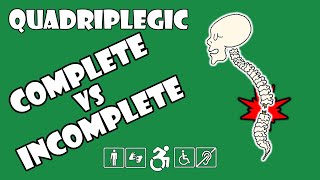 Complete vs Incomplete Spinal Cord Injury Explained  Quadriplegic C5C6C7 [upl. by Harvie]