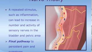 Understanding Interstitial Cystitis ICPainful Bladder Syndrome PBS [upl. by Notlef]