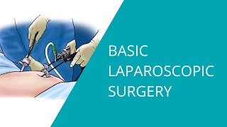 Basic Laparoscopic Surgery [upl. by Aken]