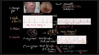 Traitement de lhypertension artérielle  Guidelines  Exercices  HTA  Docteur Synapse [upl. by Eadwina378]