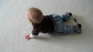 Louis starting to crawl with boots and bar talipes [upl. by Lear]