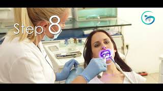 Globodent BlanQuest® Pro Instructional Video Professional In Office Teeth Whitening [upl. by Ainigriv]