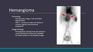 GI Imaging Liver Pathology [upl. by Leirbaj]