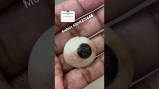 नकली आँख देखने मे असली जैसे……3d retinoblastoma artificial ophthalmology oculoplastics [upl. by Akiemahs]