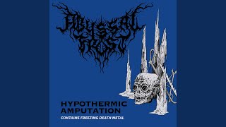 Hypothermic Amputation [upl. by Eelirol]