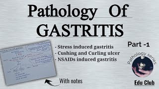 Gastritis  Acute Gastritis  Stress Ulcers  Cushing ulcer Curling ulcer  GI Pathology [upl. by Naras]