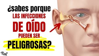 OTITIS O INFECCIÓN EN EL OIDO 🔥 Causas Síntomas Y Factores De ALTO RIESGO [upl. by Ahsi]