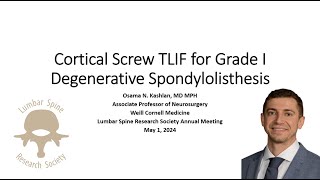 Cortical Screw TLIF for Grade 1 Degenerative Spondylolisthesis [upl. by Itteb538]