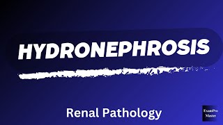 Hydronephrosis  Renal Pathology  Robbins  Easy Explanation [upl. by Kasevich38]