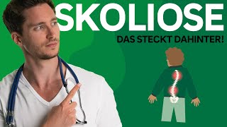 Skoliose Symptome Ursachen Therapie  AOK [upl. by Ronacin761]