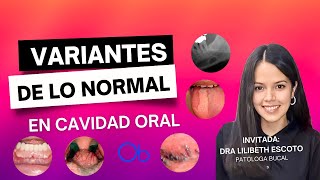 Variantes de lo normal en cavidad oral 👄 [upl. by Tnomyar]