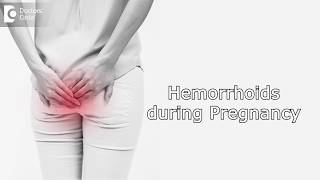 How to manage Hemorrhoids during Pregnancy  Dr Rashmi Chaudhary [upl. by Marysa376]