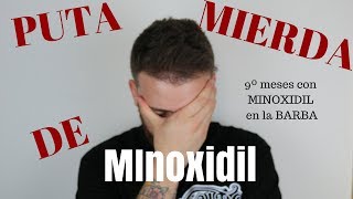 9º Meses con MINOXIDIL PUTA MIERDA DE MINOXIDIL [upl. by Dnalram299]