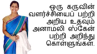 ஒரு கருவின் வளர்ச்சியைப் பற்றி அறிய உதவும் அனாமலி ஸ்கேன் பற்றி அறிந்து கொள்ளுங்கள் [upl. by Rachele963]