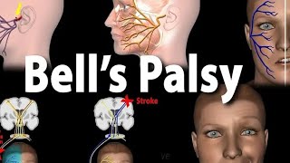 Bells palsy pathophysiology symptoms [upl. by Karlow]