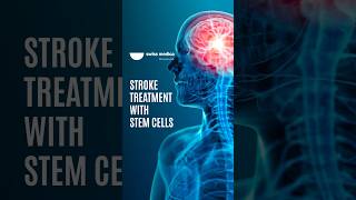 Stem Cells for Stroke Recovery stemcell stroke shorts [upl. by Lia857]