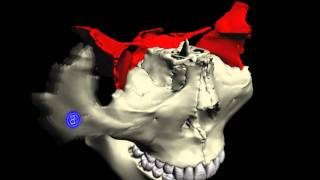 要の蝶 蝶形骨周辺の骨 Bone around Sphenoid bone [upl. by Inahs]