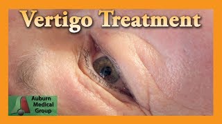 Vertigo Treatment  Auburn Medical Group [upl. by Naut]