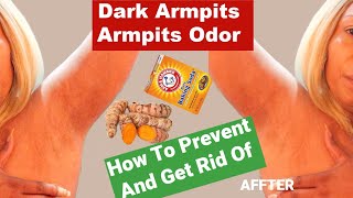 How To Instantly Get Rid Of Armpits Odor  Lighten Your Armpits [upl. by Orran264]